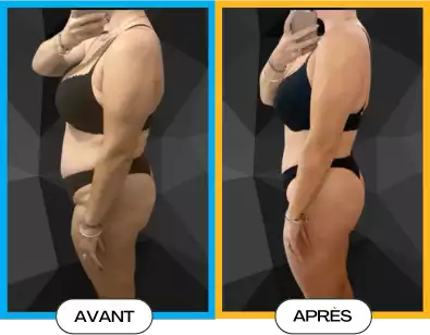 Résultats avant et après d'un programme de remise en forme avec GYM ACCESS